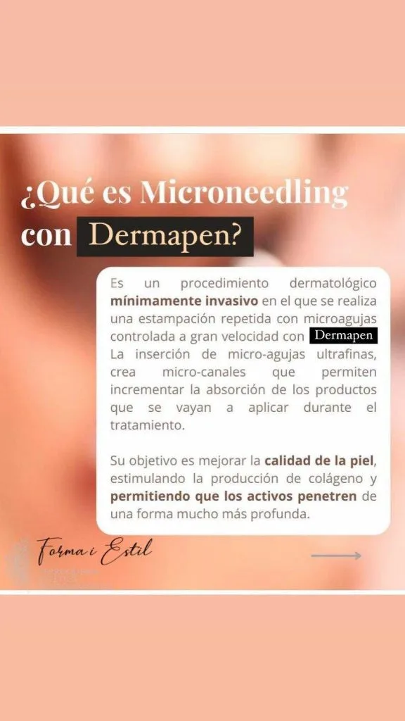 Explicación Dermapen